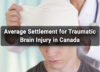 Average Settlement for Traumatic Brain Injury in Canada Featured Image